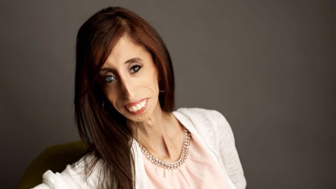 La Inspiradora Historia De Lizzie Velásquez Y Cómo Le Cambió Que La Nombrarán La Más Fea Del Mundo 