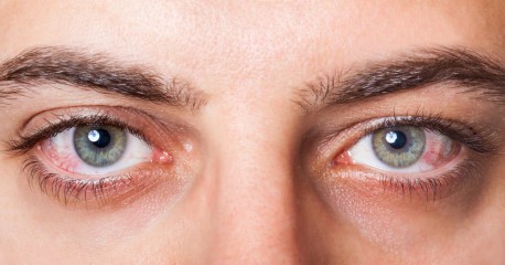 10 advertencias de salud que tus ojos te envían y cómo protegerlos