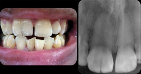 8 Hechos sobre tus DIENTES algo traumáticos que te harán querer cepillarlos MÁS