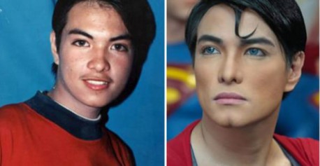 Este hombre se ha operado 26 veces para «ser Superman»