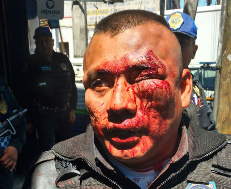 Policía golpeado en Iztapalapa por presuntos delincuentes