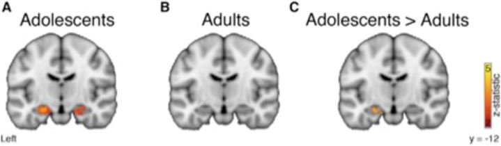 El Cerebro Adolescente Tiene La Ventaja De Aprender Mejor A Través De ...