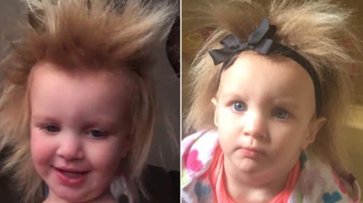 Niña tiene extraña condición en su cabello que la hace lucir siempre despeinada