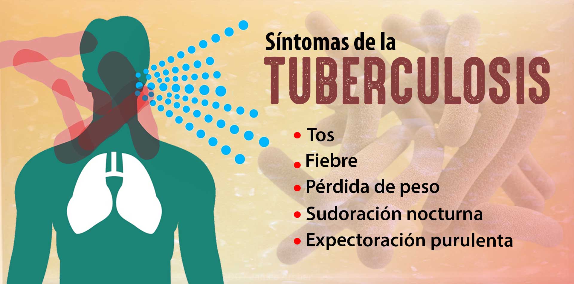 La Tuberculosis Sigue Siendo La Enfermedad M S Letal Del Mundo