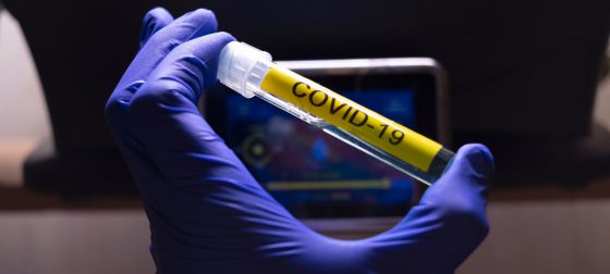 OMS pide a China invitación para investigar origen del coronavirus