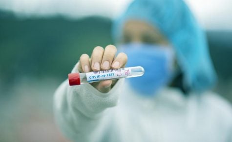 ¿Se infecta de coronavirus el semen de los hombres que resultan casos positivos?