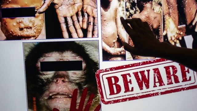 Monkeypox is spreading: What is known about the disease, where are there cases and how dangerous is it?