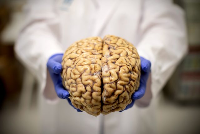 Día Mundial del Cerebro: riesgos y consejos para su cuidado