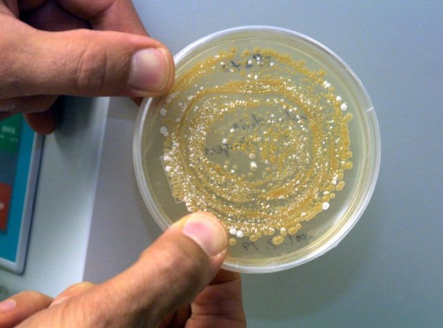 Revolución microbiana: bacterias que destruyen el Plástico