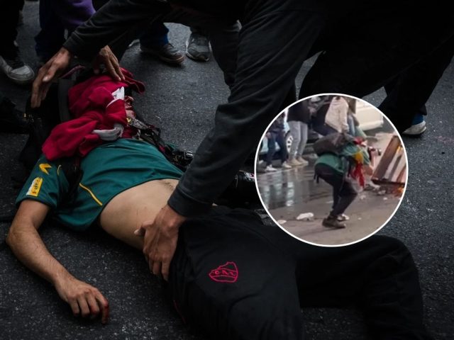 Fotoperiodista en estado crítico tras impacto de bomba lacrimógena en protesta en Buenos Aires